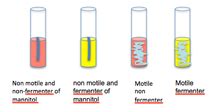 soft agar deep tests for what type of media|BISC209/S12: Motility .